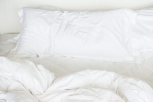 Le punture di cimici da letto: come riconoscerle